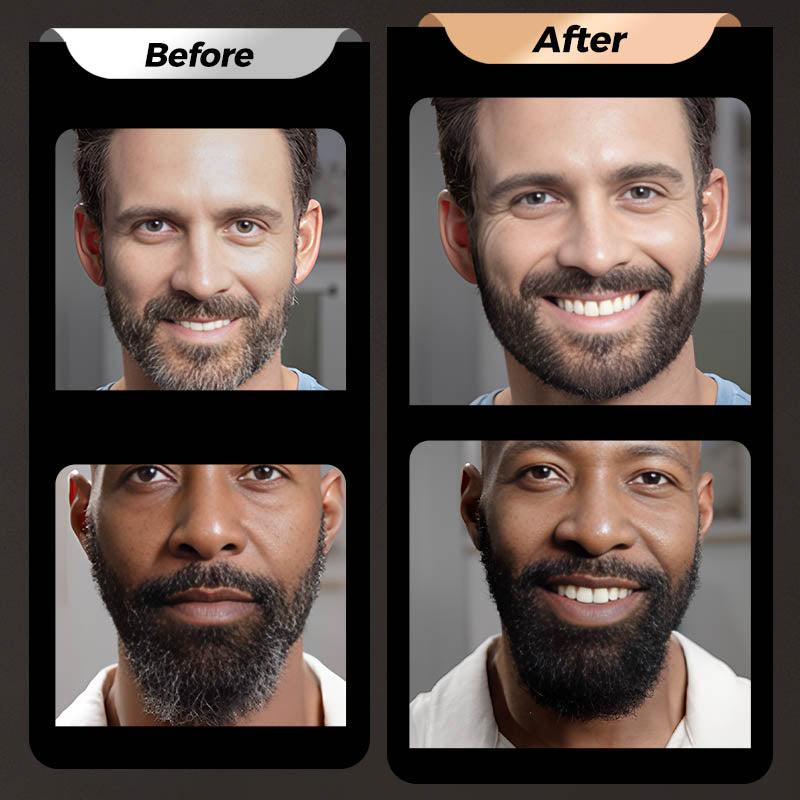 4-Prong Microblading Pen – Natural Hair-Like Brow, Beard & Hairline Filler